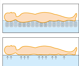 寝ているときの圧力イメージ図